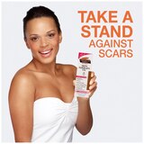 Palmer's Skin Therapy Oil Rose 5.1 fl. oz., thumbnail image