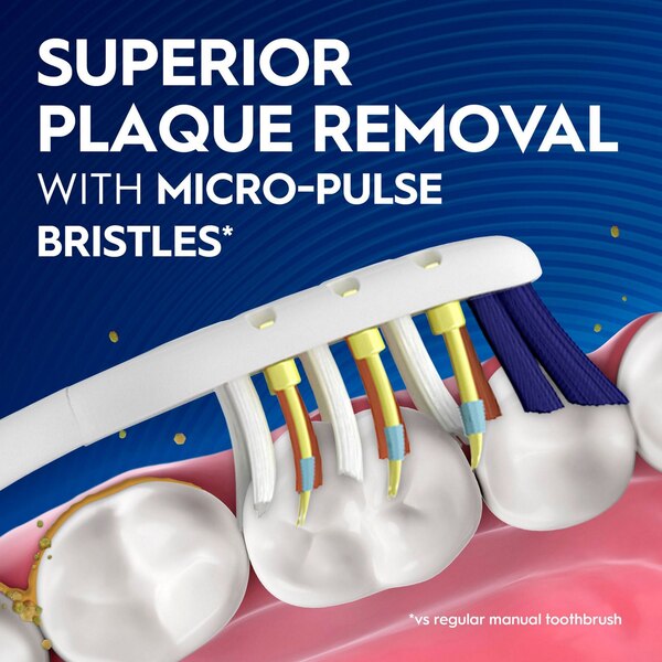 Oral-B Vibrating Pulsar Expert Clean Battery Toothbrush