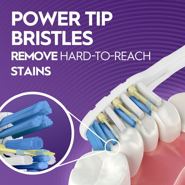 Oral-B Vibrating Pulsar Whitening Battery Toothbrush, Soft Bristle