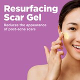 Differin Resurfacing Scar Gel, 1 OZ, thumbnail image
