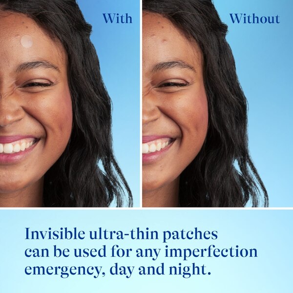 Differin Power Patch Acne-Prone Skin Patches, 36 CT