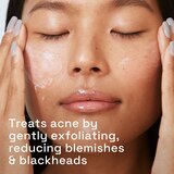 Cetaphil Gentle Clear Pore Clearing Acne Cleanser, 2% Salicylic Acid, 8 OZ, thumbnail image