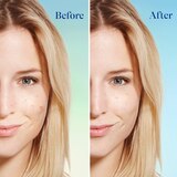Differin Daily Deep Cleanser with Benzoyl Peroxide, 4 OZ, thumbnail image