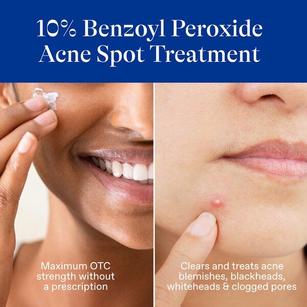Differin Acne Spot Treatment, 10% Benzoyl Peroxide, 1 OZ