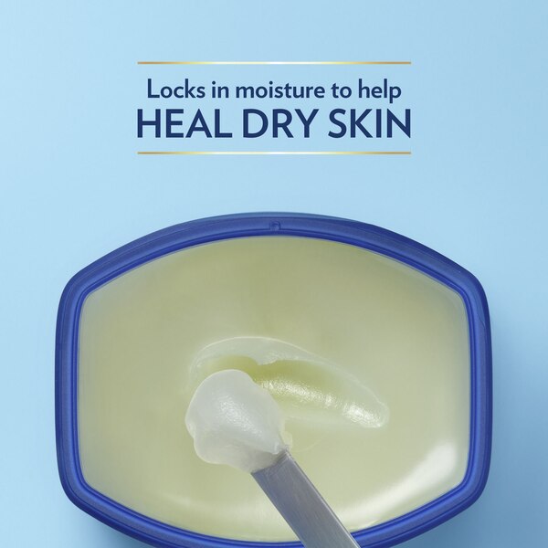 Vaseline Original Petroleum Jelly For Dry Cracked Skin and Eczema Relief, 7.5 OZ