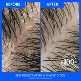 Head & Shoulders Classic Clean Dandruff Shampoo, thumbnail image 4 of 12