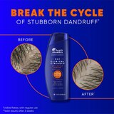 Head & Shoulders Clinical Strength Dry Scalp Rescue 2-in-1 Shampoo & Conditioner, 13.5 OZ, thumbnail image