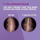 Rogaine Women's 5% Minoxidil Foam for Hair Regrowth, thumbnail image