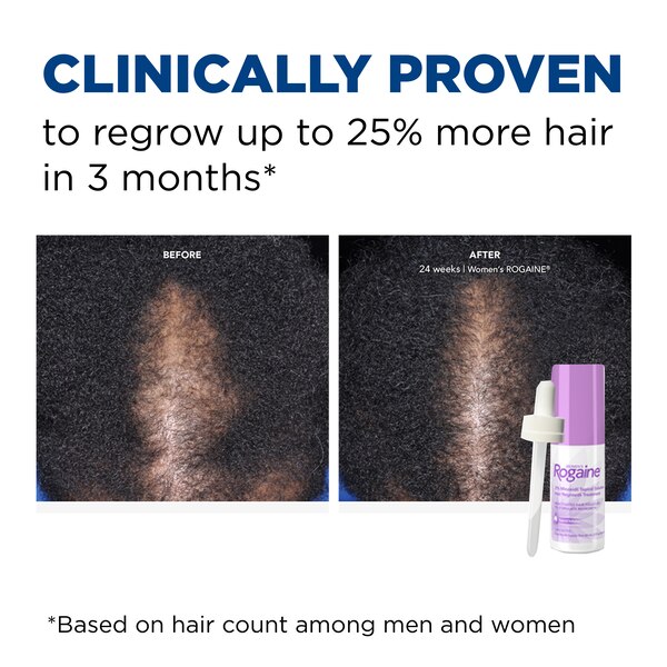 Rogaine Women's 2% Minoxidil Solution for Hair Regrowth