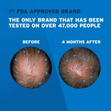 Rogaine Men's 5% Minoxidil Foam for Hair Regrowth, thumbnail image 3 of 9