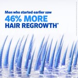 Rogaine Men's 5% Minoxidil Foam for Hair Regrowth, thumbnail image