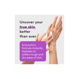 AmLactin Alpha-Hydroxy Therapy Ultra Smoothing Intensely Hydrating Cream, thumbnail image