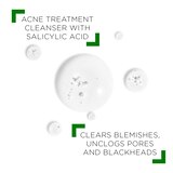Vichy Normaderm Deep Cleansing Acne Gel, Daily Face Wash, thumbnail image