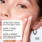 Vichy Normaderm Deep Cleansing Acne Gel, Daily Face Wash, thumbnail image