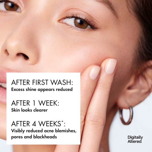 Vichy Normaderm Deep Cleansing - Gel de limpieza antiacné, uso diario