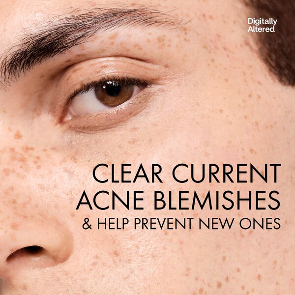 Vichy Normaderm Deep Cleansing Acne Gel, Daily Face Wash