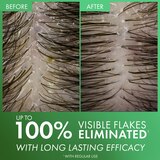 Vichy Dercos Selenium Sulfide Anti-Dandruff Shampoo, thumbnail image