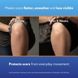 ScarAway Complete Scar Treatment Kit 0.35oz Gel + Sheets, thumbnail image 4 of 8