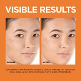 L'Oreal Paris Revitalift 12% Pure Vitamin C, E, Salicylic Acid Serum, 1.01 OZ, thumbnail image