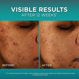 L'Oreal Paris Bright Reveal 12 Percent Niacinamide Amino Sulfonic and Ferulic Acid, thumbnail image
