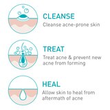 CeraVe Acne Foaming Cream Face Cleanser with 4% Benzoyl Peroxide, Hyaluronic Acid, and Niacinamide, Fragrance-Free, 5 OZ, thumbnail image