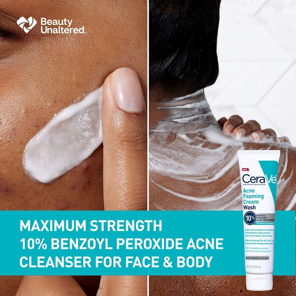 CeraVe Acne Foaming Cream Wash with 10% Benzoyl Peroxide for Face and Body , 5 oz