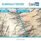 CeraVe Anti-Dandruff Hydrating Conditioner, 9 OZ, thumbnail image