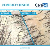 CeraVe Anti-Dandruff Hydrating 2-in-1 Shampoo and Conditioner, 12 OZ, thumbnail image