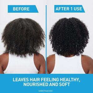 CeraVe Anti-Dandruff Hydrating 2-in-1 Shampoo and Conditioner, 12 OZ