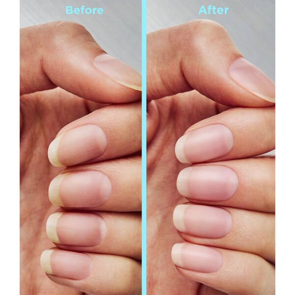 Sally Hansen Repair + Rescue Insta-Smooth Ridge Filler Nail Treatment