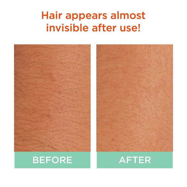  Sally Hansen Bleach Creme for Face and Body