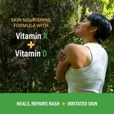 A & D Medicated Rash Ointment, 1.5 OZ, thumbnail image