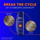Head & Shoulders Clinical Strength Dry Scalp Rescue Shampoo, 13.5 OZ, thumbnail image