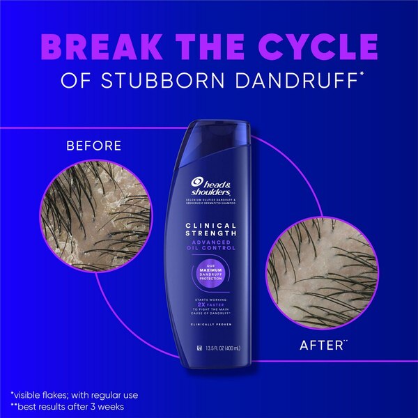 Head & Shoulders Clinical Strength Dandruff Defense + Advanced Oil Control Shampoo, 13.5 OZ