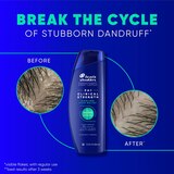 Head & Shoulders Clinical Strength Dandruff Defense Intensive Itch Relief 2-in-1 Shampoo & Conditioner, 13.5 OZ, thumbnail image