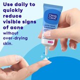 Clean & Clear Advantage Acne Spot Treatment, .75 OZ, thumbnail image