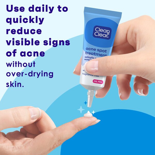 Clean & Clear Advantage Acne Spot Treatment, .75 OZ