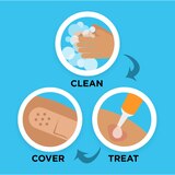 Band-Aid Brand Skin Flex Adhesive Bandages, Assorted Sizes, thumbnail image