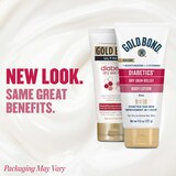 Gold Bond Diabetics' Dry Skin Relief Body Lotion, 4.5 OZ, thumbnail image 2 of 7