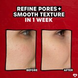 Thayers 2% AHA Toner with Glycolic and Lactic Acids, 12 oz, thumbnail image