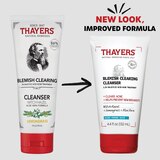 Thayer's Blemish Clearing Cleanser, 4.4 OZ, thumbnail image
