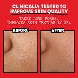 Thayers Alcohol-Free Rose Petal Witch Hazel Toner with Aloe Vera, 12 OZ, thumbnail image