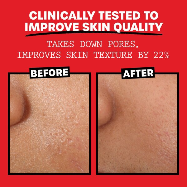 Thayers Alcohol-Free Rose Petal Witch Hazel Toner with Aloe Vera, 12 OZ
