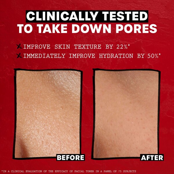 Thayers Alcohol-Free Rose Petal Witch Hazel Toner with Aloe Vera, 12 OZ