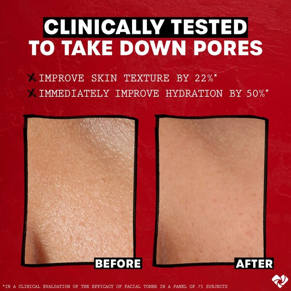 Thayers Travel Size Alcohol-Free Rose Petal Witch Hazel Toner with Aloe Vera