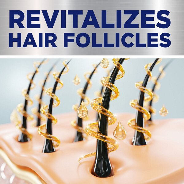 CVS Women's 2% Minoxidil Solution for Hair Regrowth