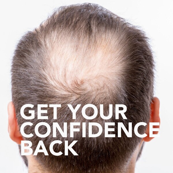 CVS Health Men's Extra Strength 5% Minoxidil Solution for Hair Regrowth