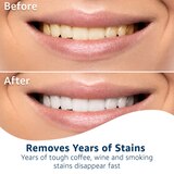 CVS Health Professional White Teeth Whitening Strips, thumbnail image