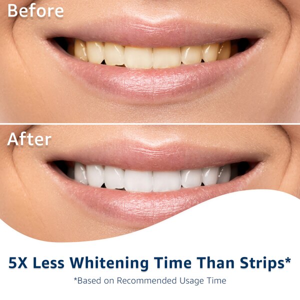 CVS Health LED Light Teeth Whitening Kit