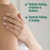 Nizoral Psoriasis Relief Cream, 4 OZ, thumbnail image